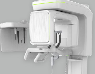 3D CBCT DIgital X-Ray scan