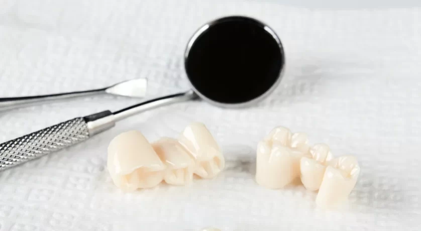 Dental Crowns in Flower Mound: Signs You May Need One