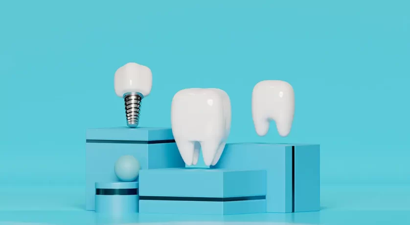 What Do Dental Implants Feel Like?