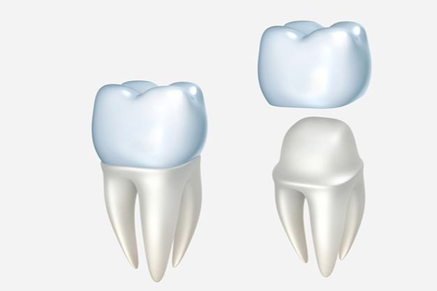 Crowns