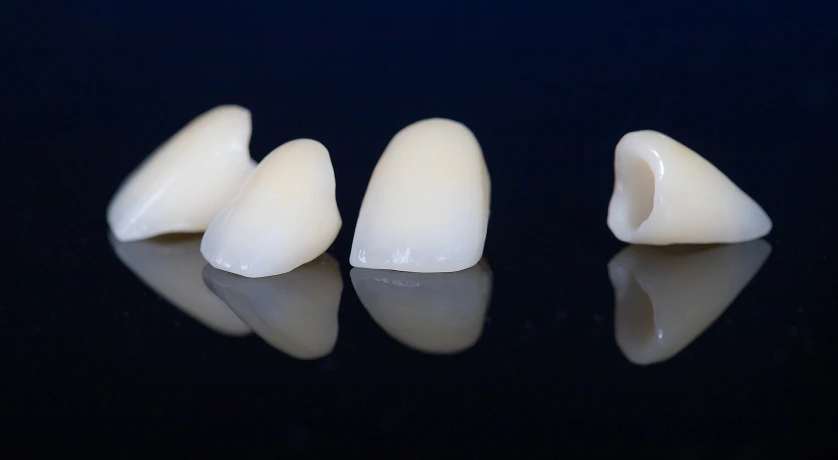 Restore Your Smile with Dental Crowns in Flower Mound!